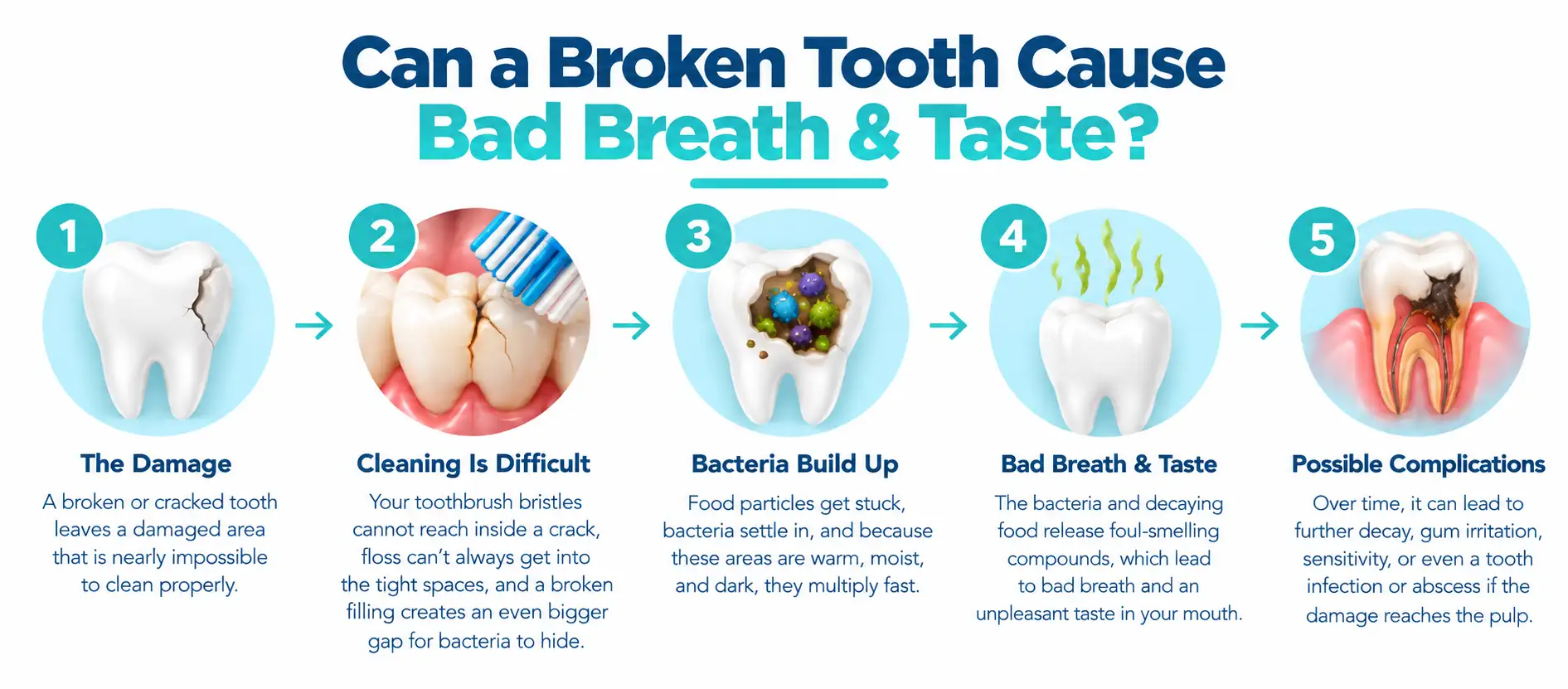 can a broken tooth cause bad breath​