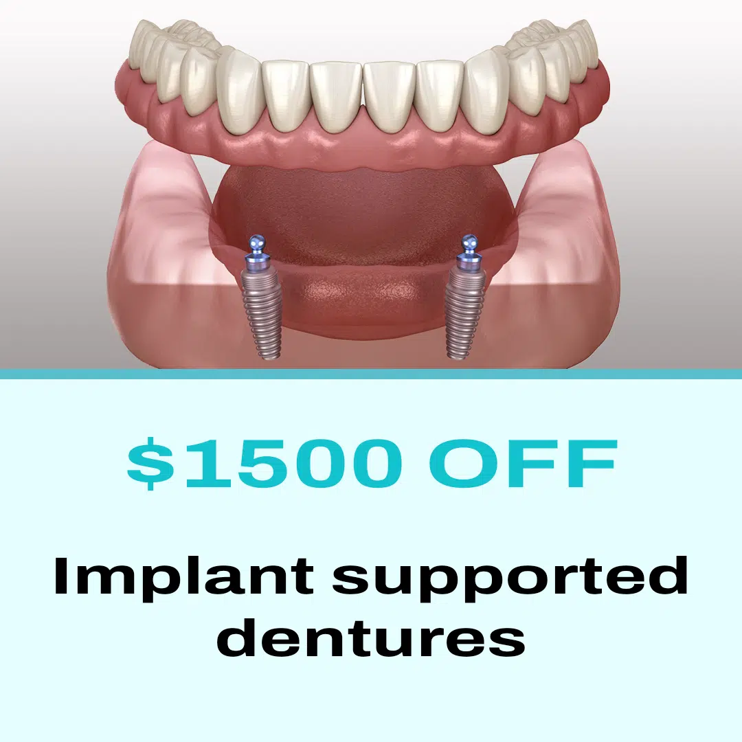 Implan supported dentures