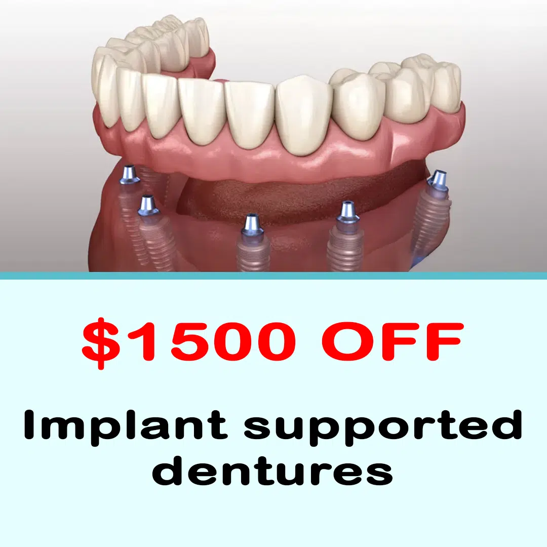 Implan supported dentures