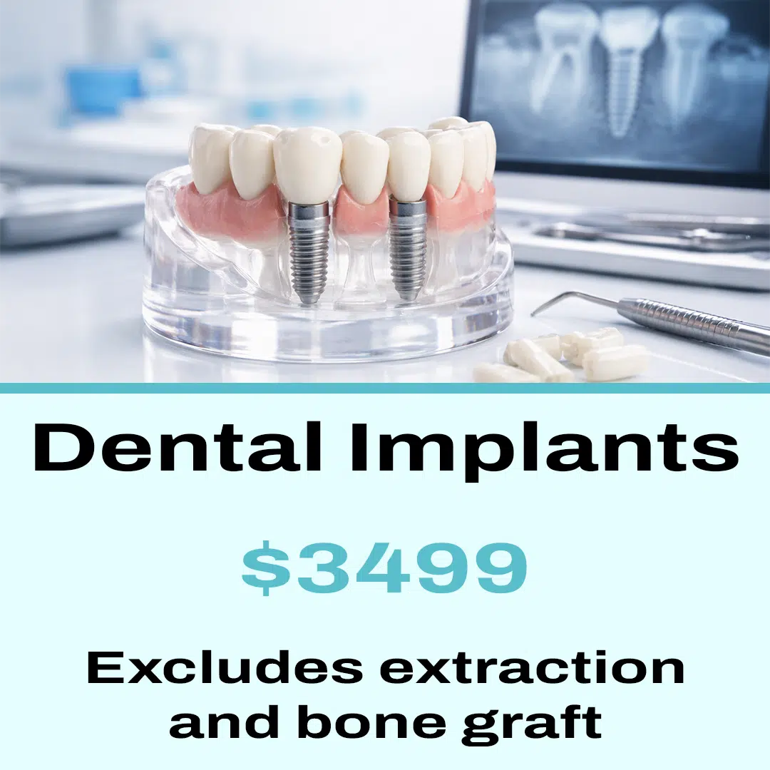 dental implants