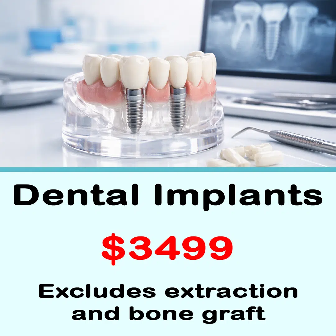 dental implants