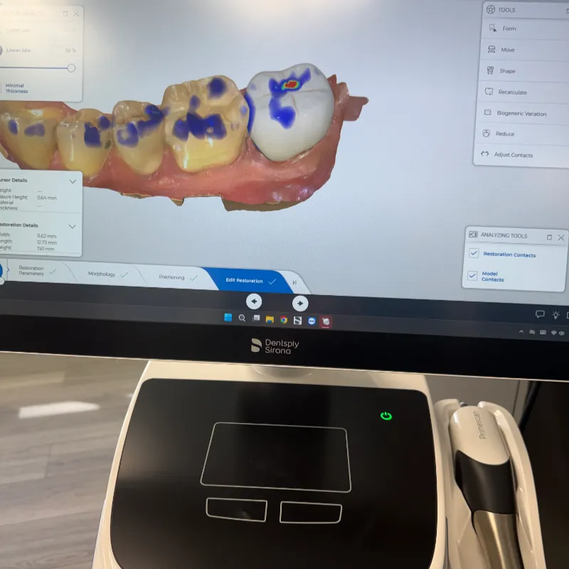 cerec machine 3