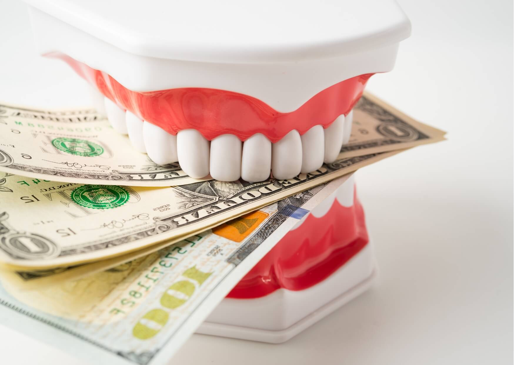 Dental veneer model placed on U.S. currency to illustrate how veneers cost by location can differ based on regional pricing and dental practice fees.